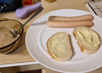 Štai koks maitinimas privačioje Vilniaus klinikoje